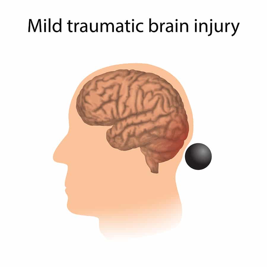 contact traumatic brain accident injury lawyer for mild concussions